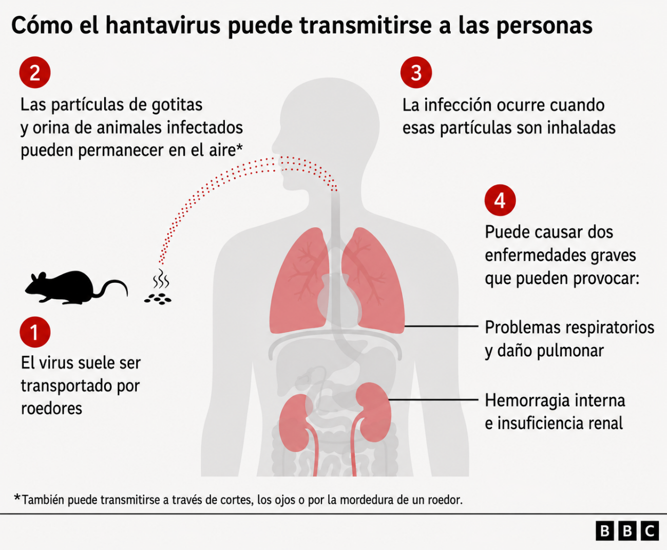 Traducció d'infografia sobre l'hantavirus publicada per la BBC.
